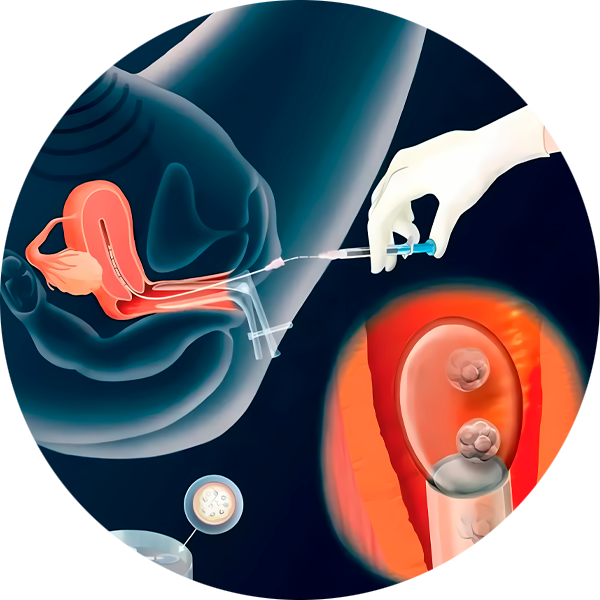 transferencia-embrionaria
